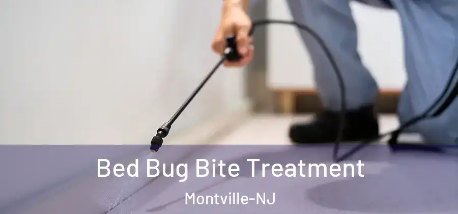 Bed Bug Bite Treatment Montville-NJ